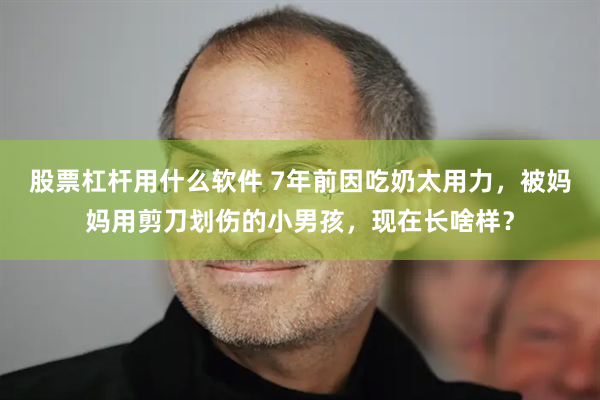 股票杠杆用什么软件 7年前因吃奶太用力，被妈妈用剪刀划伤的小男孩，现在长啥样？